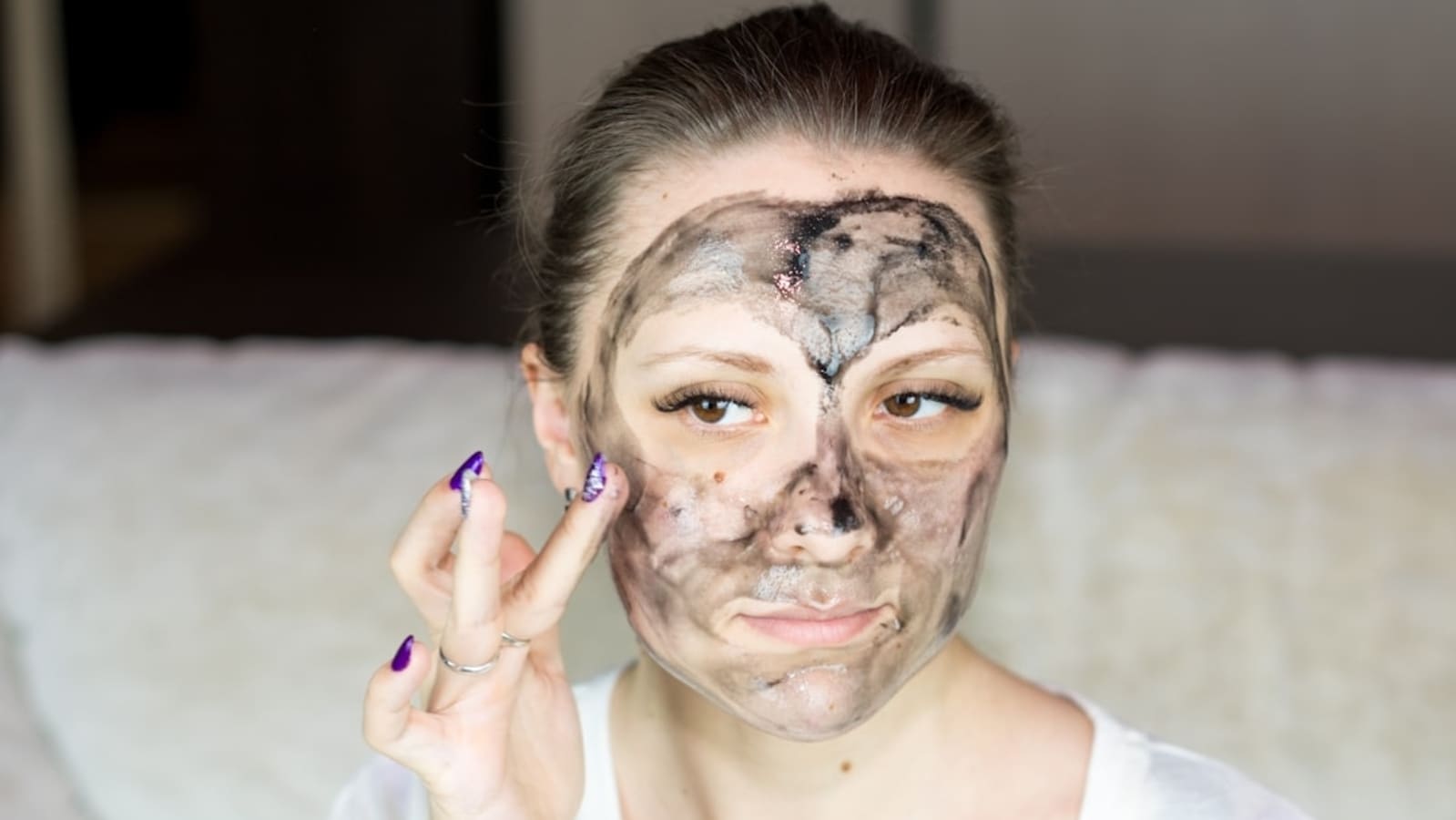 Dermatologist shares top 3 foods you need to avoid if you have acne: Sugar, dairy and especially skim milk