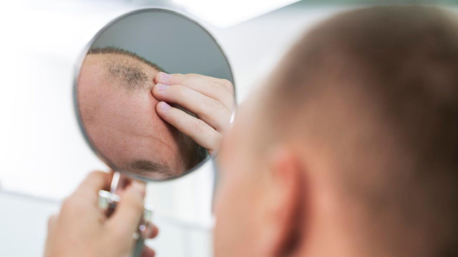 New drug shows strong phase 3 results against male baldness | Technology News